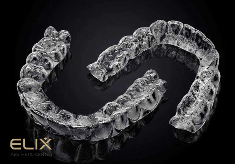 Էլայներների գինը Հայաստանում 2026 | Elix Clinic